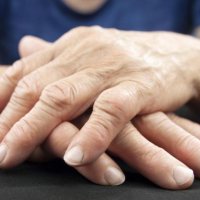 Kjo simptomë në duar mund të sinjalizojë gjendje serioze