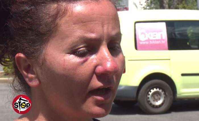 4 burra rrahin një grua në Berat, por policia nuk i pranon denoncimin
