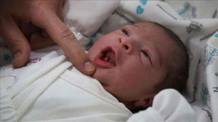 Rast i pazakontë në Turqi, pas lindjes foshnjës i hiqen dy dhëmbë