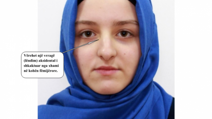Është zhdukur e mitura Elif Bajrami, kërkohet ndihma për gjetjen e saj (Foto)