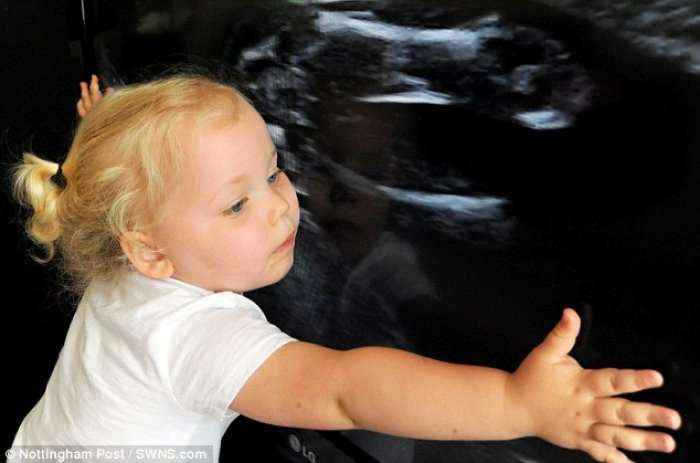 Vajza dy vjeçare shpërthen në lot kur sheh motrën e saj përmes ultrazërit (Foto/Video)