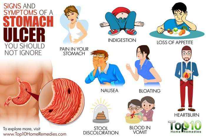 Shenjat dhe simptomat e ulcerës së lukthit, të cilat nuk duhet t'i injoroni