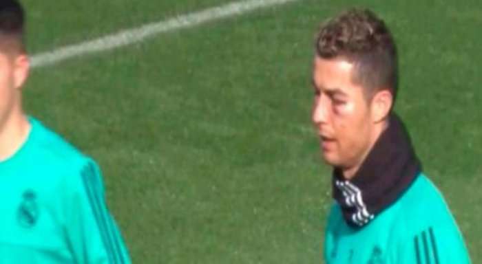 Ronaldo mungon kundër Leganes shkaku i lëndimit