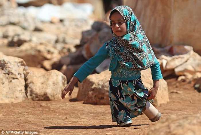 8 vjeçarja siriane dhe babai i saj humbin këmbët, i zëvendësojnë me llamarinë