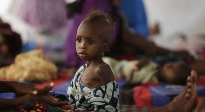 Alarmi: Çdo minutë në botë 5 fëmijë vdesin nga uria