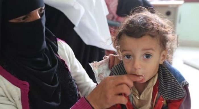Lufta në Jemen, fëmijët po vuajnë nga uria