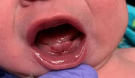 Lind një foshnjë me dhëmbë