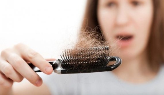 A u zbulua ilaçi për parandalimin e rënies së flokëve?