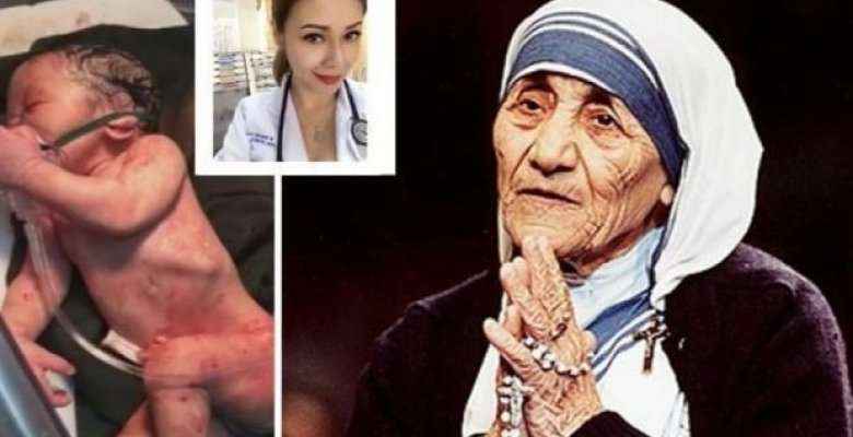 Mrekulli: Doktoresha filipineze ‘ngjall’ beben e vdekur duke iu lutur Nënë Terezës