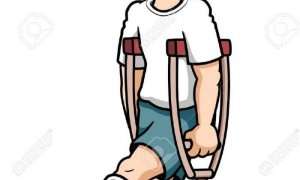 Break a leg idiom. Break a leg. Broken your leg. Break a leg картинки. Break a leg.