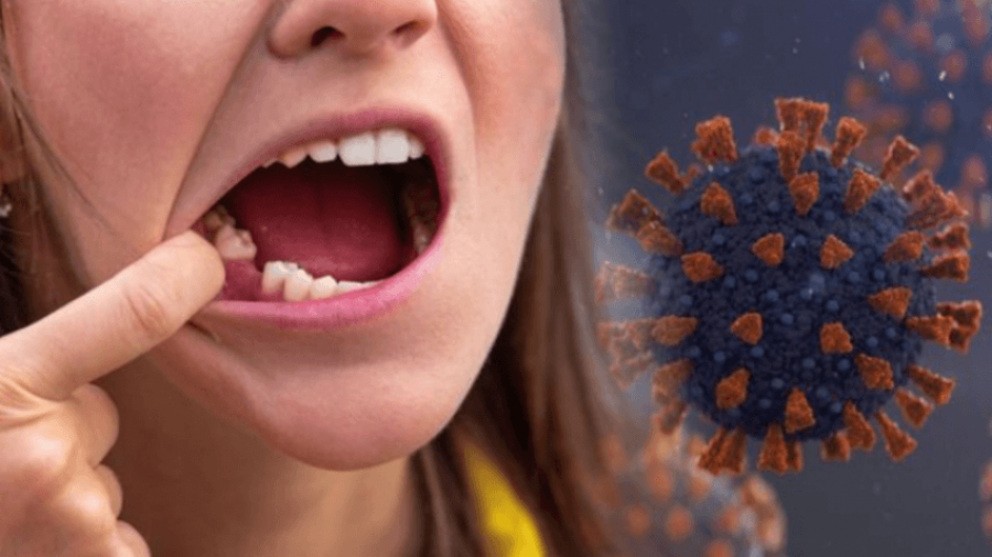 Simptomë e re e gjatë e COVID-19: Mund të bëjë që dhëmbët e të infektuarve të bien
