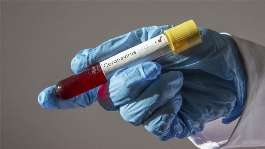 1 mijë e 16 persona kanë vdekur nga koronavirusi në Kosovë
