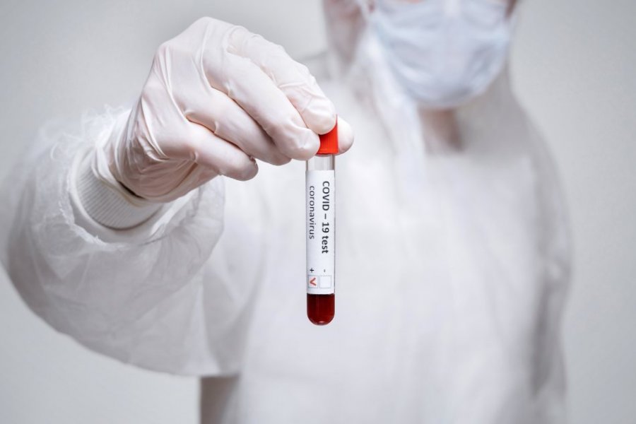 ShBA-ja shënon rekord të frikshëm të rasteve ditore të koronavirusit