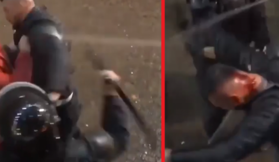 Momenti kur policia në Shqipëri ia çajnë kokën protestuesit me shufër