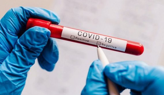 Mbi 48 milionë të shëruar nga COVID-19 në botë