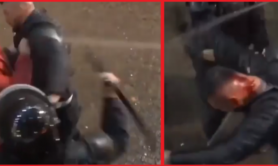 Momenti kur policia në Shqipëri ia çajnë kokën protestuesit me shufër
