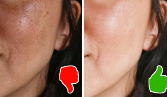 Çfarë ndodh me lëkurën, nëse lani fytyrën tuaj vetëm një herë në ditë?
