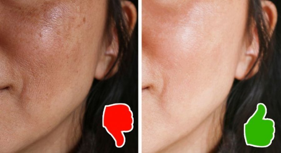 Çfarë ndodh me lëkurën, nëse lani fytyrën tuaj vetëm një herë në ditë?