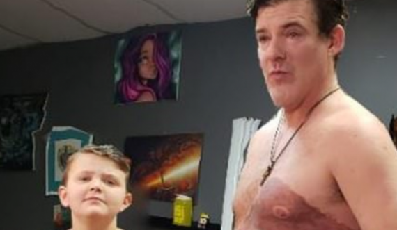 Djalit turpërohej nga shenja e lindjes, babai e bën tatuazh