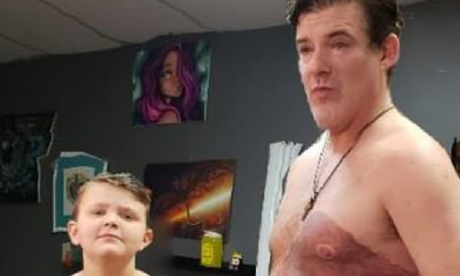 Djalit turpërohej nga shenja e lindjes, babai e bën tatuazh