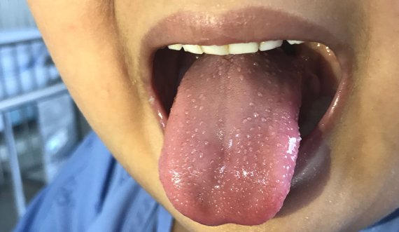 Habiten dentistët, e pabesueshme çfarë i ka nxjerrë nga goja nëna fëmijës së saj