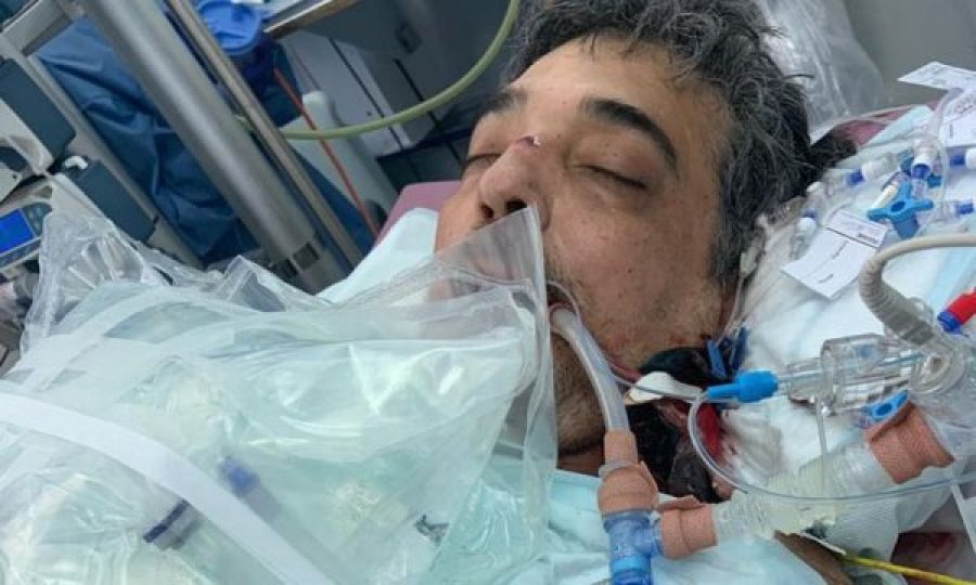 Flet 57-vjeçari i cili mundi koronavirusin pas 222 ditësh në spital