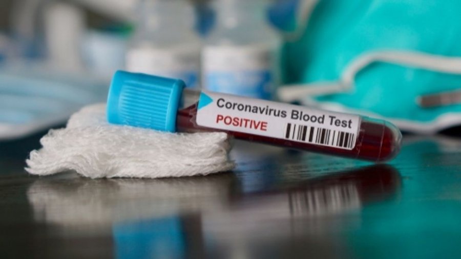  10 mijë e 721 raste aktive me koronavirus në Kosovë 