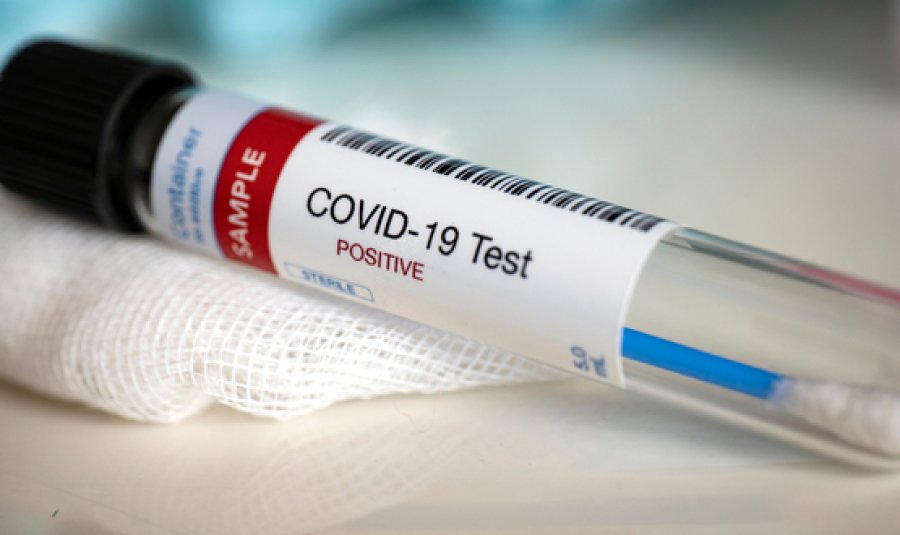 58 të vdekur nga koronavirusi që nga fillimi i pandemisë në Kosovë 