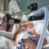 Pajisja që e mban gjallë një pacient në Infektivë me Covid-19: Mësoni pak për respiratorin