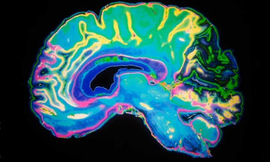 Shkencëtarët zbulojnë dëmtim serioz të trurit te personat me simptoma të lehta të Covid-19