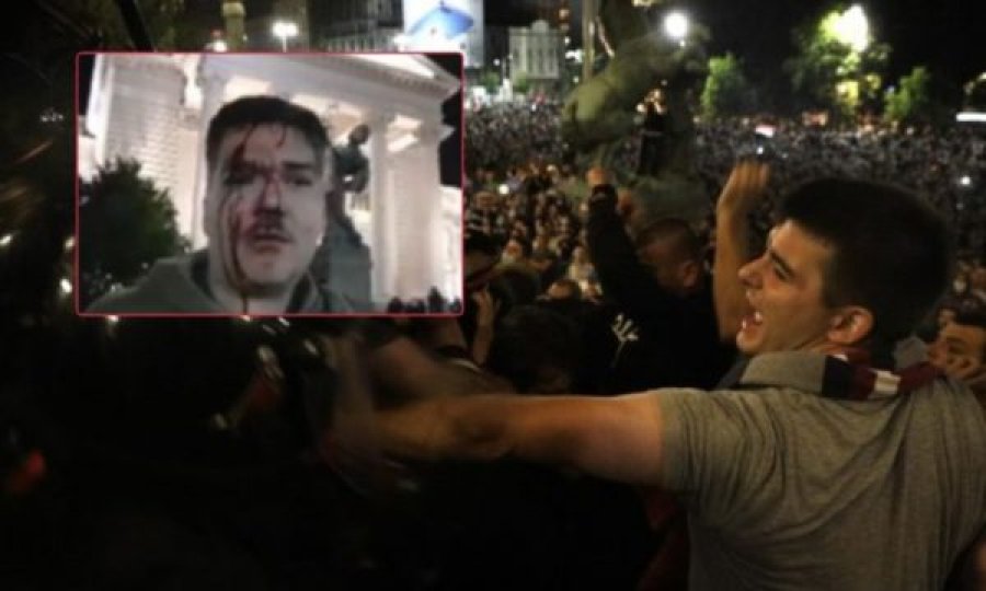 “Arrestoni Vuçiqin” – foto të dhunës e protestuesve të përgjakur në Beograd
