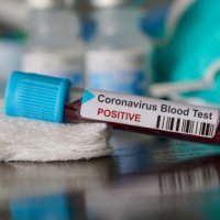 Edhe 205 raste të reja me koronavirus në Kosovë — shërohen 61 pacientë të tjerë