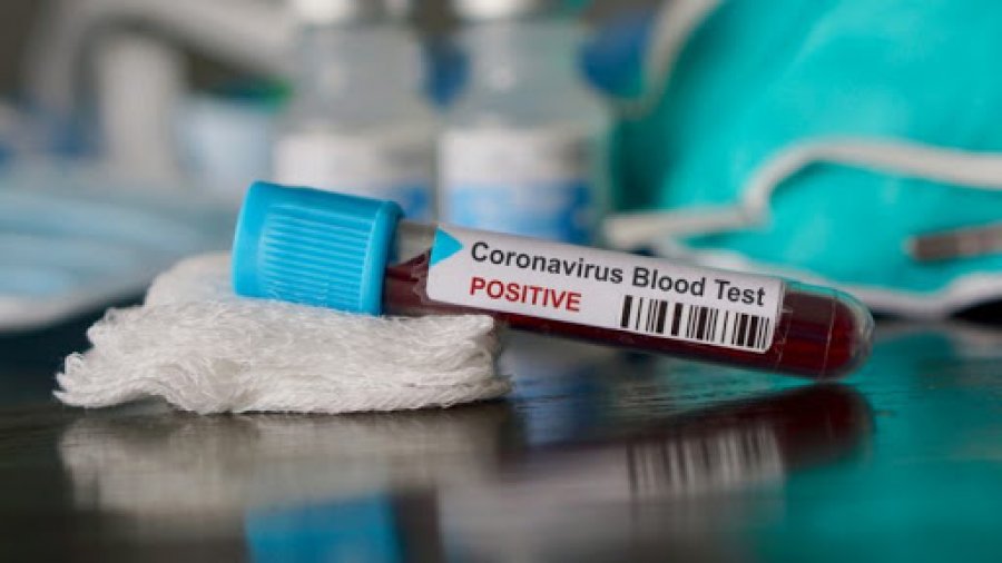  Edhe 205 raste të reja me koronavirus në Kosovë — shërohen 61 pacientë të tjerë 