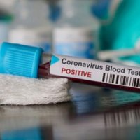 Numri i të infektuarve, të vdekurve dhe të shëruarve nga COVID-19 në të gjitha komunat e Kosovës