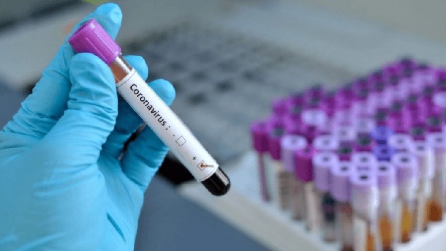 Për herë të parë nga 10 marsi, Belgjika shënon zero viktima të koronavirusit për 24 orë