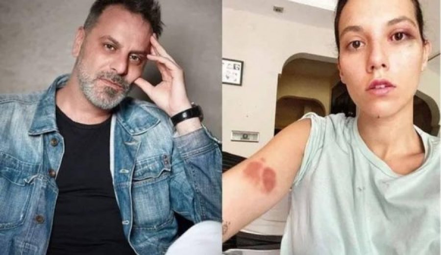 Dhunoi të dashurën, prokuroria kërkon dënim me 13 vite burg për aktorin turk