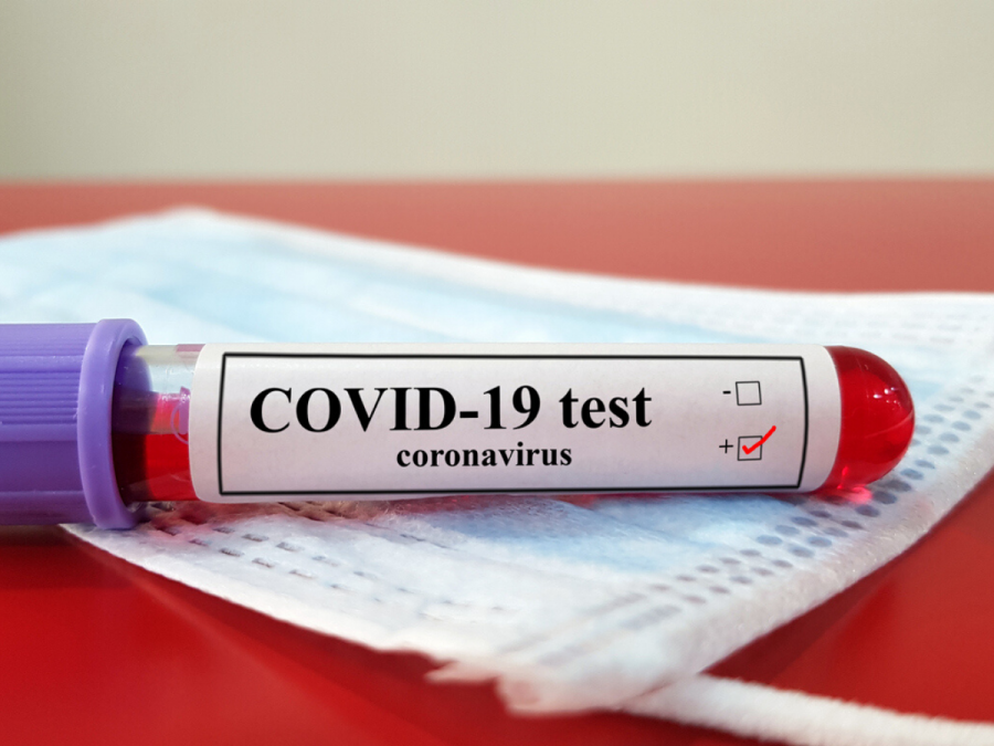 Ekspertët të shqetësuar, zbulojnë lidhjen mes Covid-19 dhe mpikjes së gjakut
