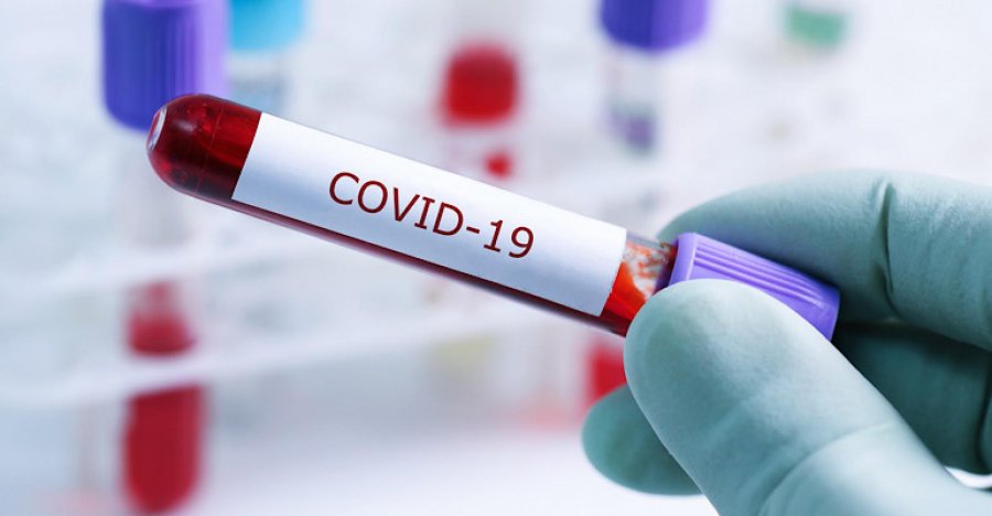 Për dhjetë ditë mbi 100 të vdekur nga COVID-19