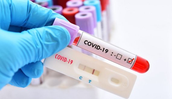  Vetëm 75 të shëruar nga COVID-19, shkon mbi 7 mijë e 200 numri i rasteve aktive 