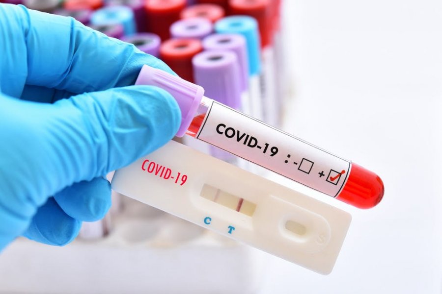  Vetëm 75 të shëruar nga COVID-19, shkon mbi 7 mijë e 200 numri i rasteve aktive 