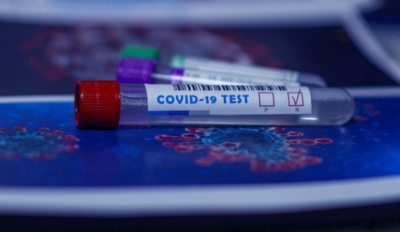  Shërohen 250 persona nga koronavirusi në Kosovë 
