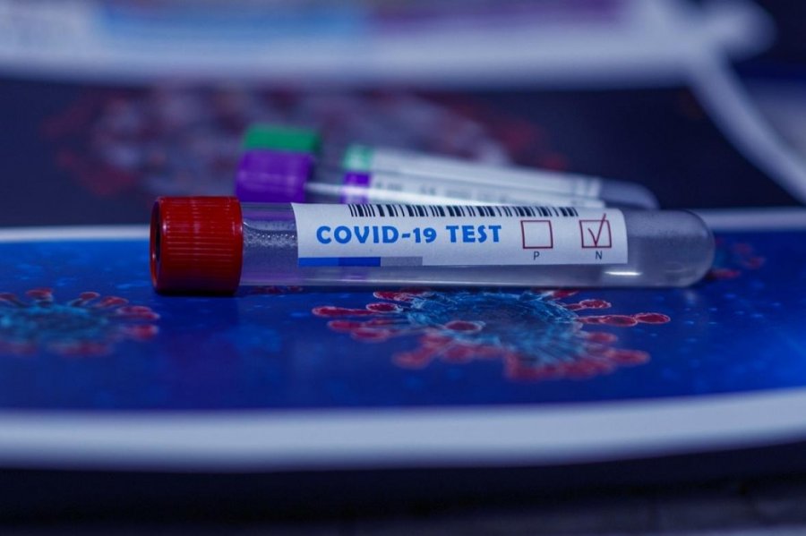  Shërohen 250 persona nga koronavirusi në Kosovë 