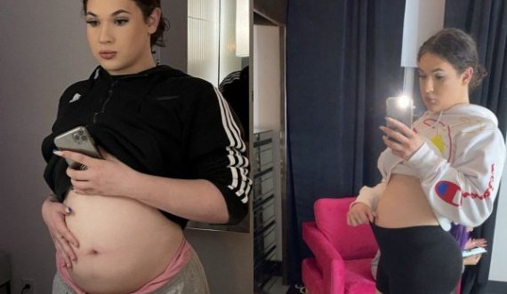 18-vjeçari me dy lloj organesh gjenitale mbetet shtatzënë