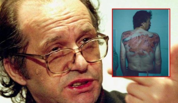 Pamje të rënda:  Në këtë mënyrë ishte rrahur brutalisht nga policia serbe një shqiptar që kishte thënë se ka votuar për Ibrahim Rugovën