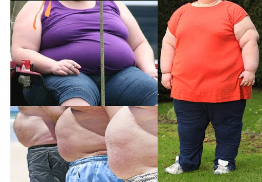 Pas disa viteve, katër miliardë e njerëzve do të jenë në mbipeshë