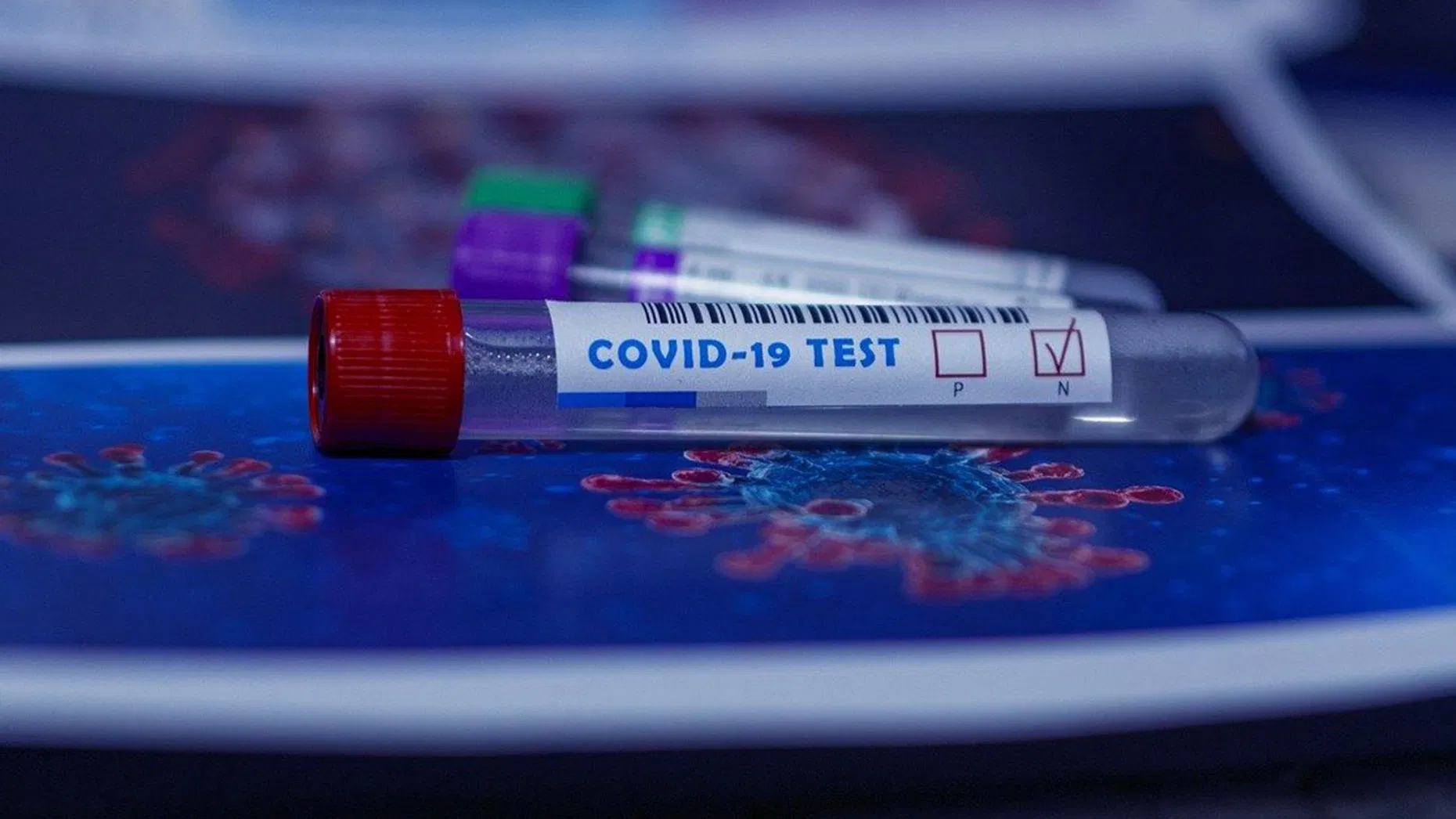 Koronavirusi në Shqipëri: 14 viktima dhe 565 infektime të reja, ulet numri i testimeve 