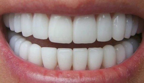 Bëni dhëmbët e bardhë në shtëpi për vetëm 3 minuta