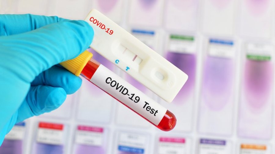 Shkon në 1,294 numri i rasteve aktive me koronavirus në Kosovë