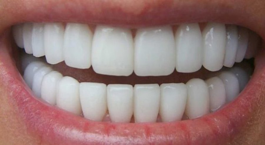 Bëni dhëmbët e bardhë në shtëpi për vetëm 3 minuta