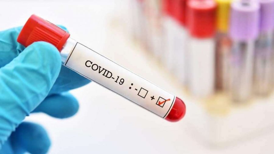 Rritet numri i infektimeve me COVID në Kosovë, 3 të vdekur